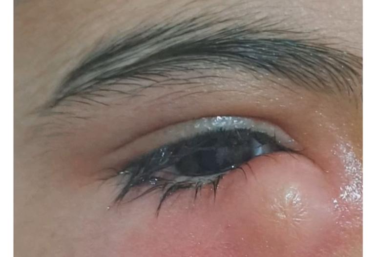 نگاه درخشان خورشید
